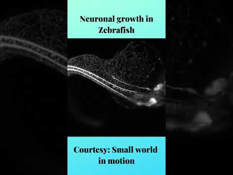 Neuron growth in Zebrafish